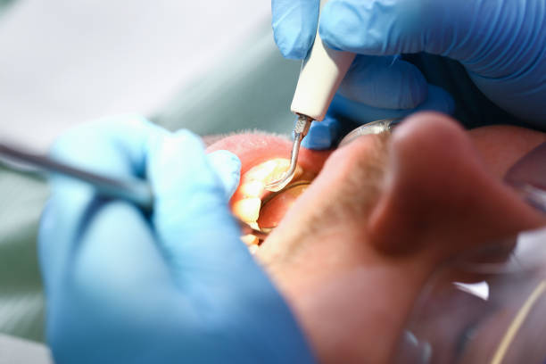 Best Emergency Treatment for Oral Infections in El Paso, IL